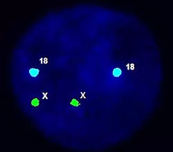 FISH interfázní jádro