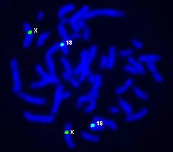 FISH metafázních chromozomů