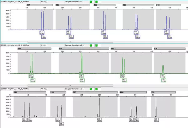 Vyšetření aneuploidií